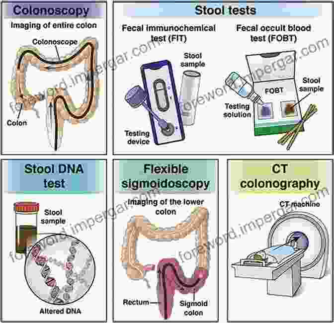 Colorectal Cancer Screening Infographic Showing The Different Screening Options And Their Effectiveness. Colorectal Cancer Screening An Issue Of Gastrointestinal Endoscopy Clinics (The Clinics: Internal Medicine)