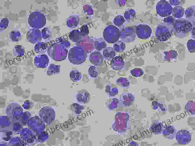 Leukemias And Lymphomas: Human Cell Culture Cancer Cell Lines: Part 3: Leukemias And Lymphomas (Human Cell Culture)