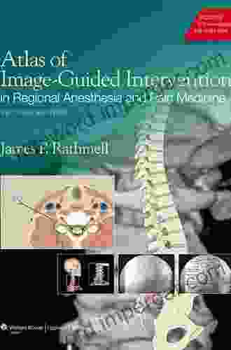 Atlas Of Image Guided Intervention In Regional Anesthesia And Pain Medicine