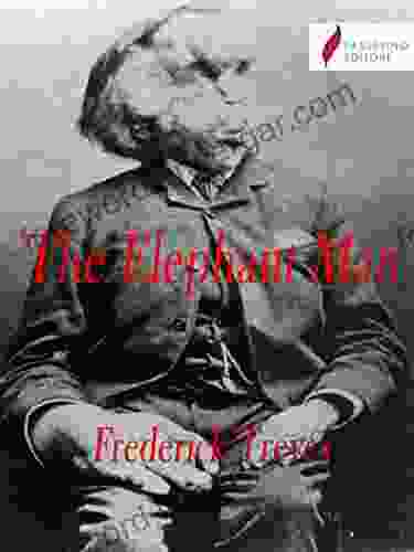 The Elephant Man Elizabeth Charnock